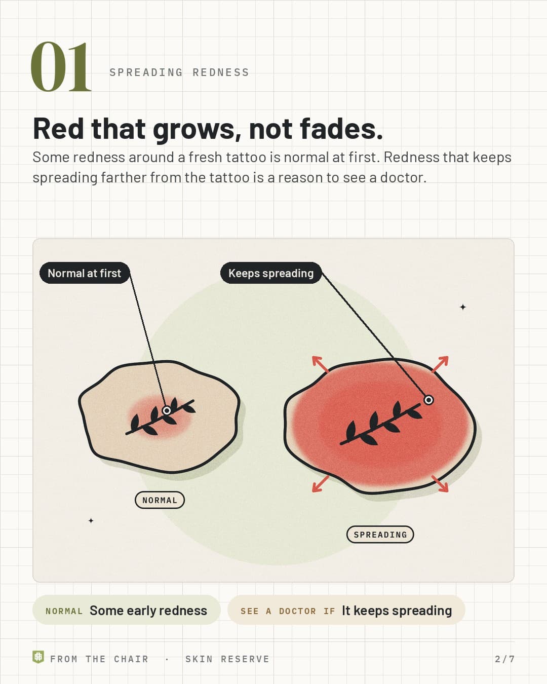 Spreading redness: a small normal pink halo next to redness spreading outward